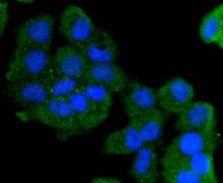 Cytokeratin 13 Rabbit anti-Human, Clone: 5A3, Bioss 100 &mu;L; Unconjugated:Antibodies,