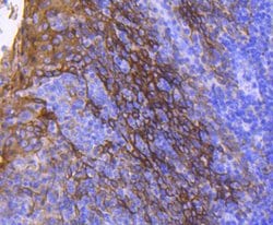 Cytokeratin 13 Rabbit anti-Human, Clone: 5A3, Bioss 100 &mu;L; Unconjugated:Antibodies,