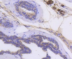 Cytokeratin 14 Rabbit anti-Human, Clone: 2F11, Bioss 100 &mu;L; Unconjugated:Antibodies,