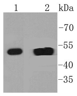 Cytokeratin 14 Rabbit anti-Human, Clone: 2F11, Bioss 100 &mu;L; Unconjugated:Antibodies,