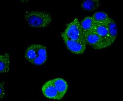 Cytokeratin 4 Rabbit anti-Human, Clone: 2F9, Bioss 100 &mu;L; Unconjugated:Antibodies,