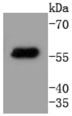 Cytokeratin 4 Rabbit anti-Human, Clone: 2F9, Bioss 100 &mu;L; Unconjugated:Antibodies,