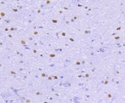 HDAC2 Rabbit anti-Human, Clone: 3B7, Bioss 100 &mu;L; Unconjugated:Antibodies,