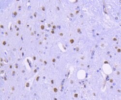 HDAC2 Rabbit anti-Human, Clone: 3B7, Bioss 100 &mu;L; Unconjugated:Antibodies,