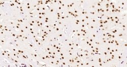 HDAC2 Rabbit anti-Human, Clone: 3B7, Bioss 100 &mu;L; Unconjugated:Antibodies,