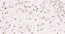 HDAC2 Rabbit anti-Human, Clone: 3B7, Bioss 100 &mu;L; Unconjugated:Antibodies,