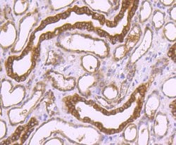 Peroxiredoxin 1 Rabbit anti-Human, Clone: 7A1, Bioss 100 &mu;L; Unconjugated:Antibodies,