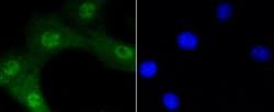Phospho-Akt1 (Ser473) Rabbit anti-Human, Clone: 12A1, Bioss 100 &mu;L;