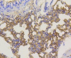 Phospho-Akt1 (Ser473) Rabbit anti-Human, Clone: 12A1, Bioss 100 &mu;L;