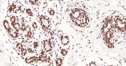 Phospho-Estrogen Receptor alpha (Ser118) Rabbit anti-Human, Clone: 3A7,