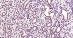 Phospho-Estrogen Receptor alpha (Ser118) Rabbit anti-Human, Clone: 3A7,