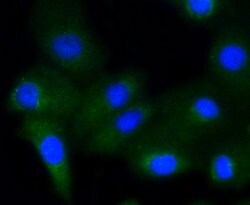Phospho-Glycogen synthase 1 (Ser641) Rabbit anti-Human, Clone: 10C1, Bioss
