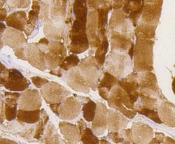 Phospho-Glycogen synthase 1 (Ser641) Rabbit anti-Human, Clone: 10C1, Bioss