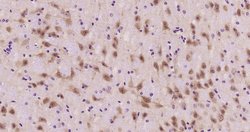 Phospho-HSF1 (Ser326) Rabbit anti-Human, Clone: 37E4, Bioss 100 &mu;L | Buy Online | Bioss | Fisher Scientific