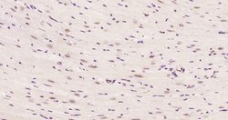 Phospho-HSF1 (Ser326) Rabbit anti-Human, Clone: 37E4, Bioss 100 &mu;L | Buy Online | Bioss | Fisher Scientific