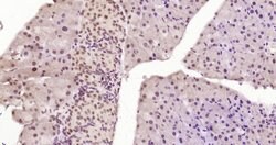 Phospho-HSF1 (Ser326) Rabbit anti-Human, Clone: 37E4, Bioss 100 &mu;L | Buy Online | Bioss | Fisher Scientific