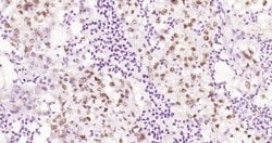 Phospho-HSF1 (Ser326) Rabbit anti-Human, Clone: 37E4, Bioss 100 &mu;L | Buy Online | Bioss | Fisher Scientific