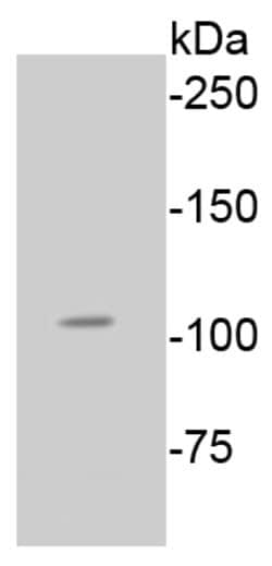 Phospho-Rb (Ser807) Rabbit anti-Human, Clone: 2D10, Bioss 100 &mu;L; Unconjugated:Antibodies,