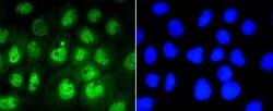 Phospho-STAT3 (Ser727) Rabbit anti-Human, Clone: 4G1, Bioss 100 &mu;L;