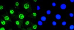Phospho-STAT3 (Ser727) Rabbit anti-Human, Clone: 4G1, Bioss 100 &mu;L;