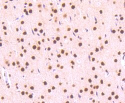 Phospho-STAT3 (Ser727) Rabbit anti-Human, Clone: 4G1, Bioss 100 &mu;L;