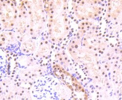 Phospho-STAT3 (Ser727) Rabbit anti-Human, Clone: 4G1, Bioss 100 &mu;L;