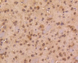 Smad4 Rabbit anti-Human, Clone: 3A1, Bioss 100 &mu;L; Unconjugated:Antibodies,
