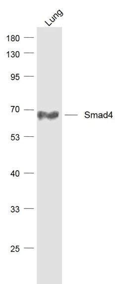 Smad4 Rabbit anti-Human, Clone: 3A1, Bioss 100 &mu;L; Unconjugated:Antibodies,