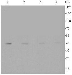 Glucose Transporter GLUT1 Rabbit anti-Human, Clone: 2D5 , Bioss 100 &mu;L;