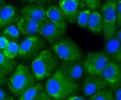 NF-kB p65 Rabbit anti-Human, Clone: 3G1, Bioss 100 &mu;L; Unconjugated:Antibodies,