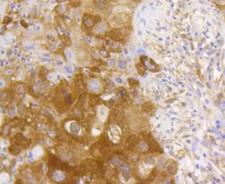 NF-kB p65 Rabbit anti-Human, Clone: 3G1, Bioss 100 &mu;L; Unconjugated:Antibodies,