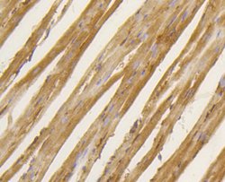 BDNF Rabbit anti-Human, Clone: 2A1, Bioss 100 &mu;L; Unconjugated:Antibodies,