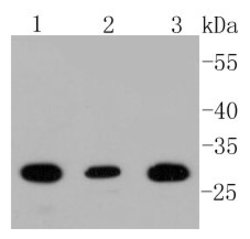 BDNF Rabbit anti-Human, Clone: 2A1, Bioss 100 &mu;L; Unconjugated:Antibodies,