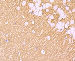 Synaptophysin Rabbit anti-Human, Clone: 2B1, Bioss 100 &mu;L; Unconjugated:Antibodies,