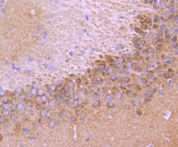 TrkA+B+C Rabbit anti-Human Mouse Rat, Clone: 5T6, Bioss 100 &mu;L; Unconjugated:Antibodies,