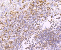PKC delta Rabbit anti-Human, Clone: 2C4, Bioss 100 &mu;L; Unconjugated:Antibodies,