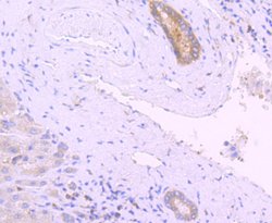 PKC delta Rabbit anti-Human, Clone: 2C4, Bioss 100 &mu;L; Unconjugated:Antibodies,