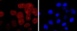 RAGE Rabbit anti-Human, Clone: 8G4, Bioss 100 &mu;L; Unconjugated:Antibodies,