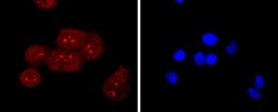 RAGE Rabbit anti-Human, Clone: 8G4, Bioss 100 &mu;L; Unconjugated:Antibodies,