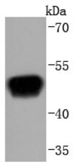 RAGE Rabbit anti-Human, Clone: 8G4, Bioss 100 &mu;L; Unconjugated:Antibodies,