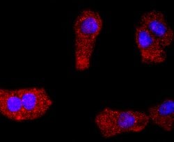 PDGFRA Rabbit anti-Human, Clone: 5A1, Bioss 100 &mu;L; Unconjugated:Antibodies,
