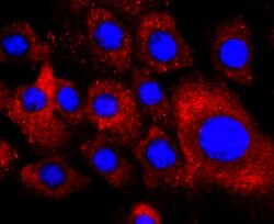 PDGFRA Rabbit anti-Human, Clone: 5A1, Bioss 100 &mu;L; Unconjugated:Antibodies,