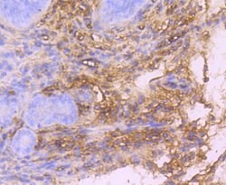 PDGFRA Rabbit anti-Human, Clone: 5A1, Bioss 100 &mu;L; Unconjugated:Antibodies,