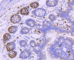 PDGFRA Rabbit anti-Human, Clone: 5A1, Bioss 100 &mu;L; Unconjugated:Antibodies,