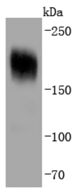 PDGFRA Rabbit anti-Human, Clone: 5A1, Bioss 100 &mu;L; Unconjugated:Antibodies,
