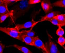 NMDAR1 Rabbit anti-Human, Clone: 13C4, Bioss 100 &mu;L; Unconjugated:Antibodies,