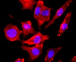 NMDAR1 Rabbit anti-Human, Clone: 13C4, Bioss 100 &mu;L; Unconjugated:Antibodies,