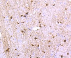 NMDAR1 Rabbit anti-Human, Clone: 13C4, Bioss 100 &mu;L; Unconjugated:Antibodies,