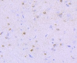 NMDAR1 Rabbit anti-Human, Clone: 13C4, Bioss 100 &mu;L; Unconjugated:Antibodies,