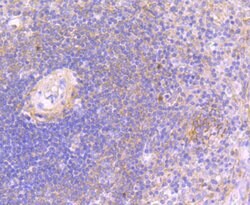 JAK3 Rabbit anti-Human, Clone: 1A1, Bioss 100 &mu;L; Unconjugated:Antibodies,